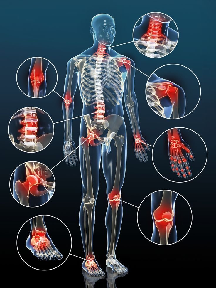 Warm-up aching joints__Ayurvedic medicine for joint pain